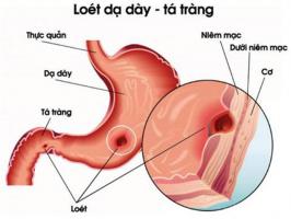 Bệnh viện khám và điều trị bệnh dạ dày tốt nhất tại Hà Nội