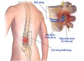 Bác sĩ khám chữa Cột sống giỏi nhất tại Hà Nội