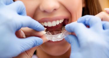 Địa chỉ niềng răng uy tín nhất quận Tây Hồ, Hà Nội