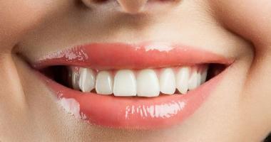 Địa chỉ tẩy trắng răng uy tín nhất tỉnh Quảng Nam