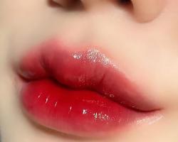 Địa chỉ tiêm filler - botox uy tín và chất lượng nhất Vũng Tàu