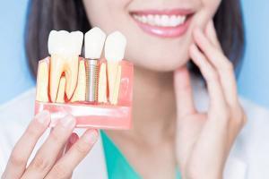 Địa chỉ trồng răng Implant uy tín, chất lượng nhất tại Bình Dương