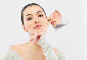 Kem trị sẹo Đông y tốt nhất hiện nay