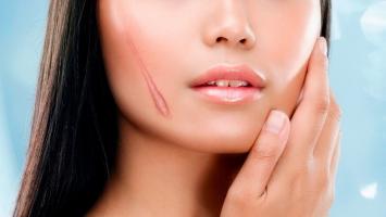 Kem trị sẹo Nhật tốt nhất hiện nay