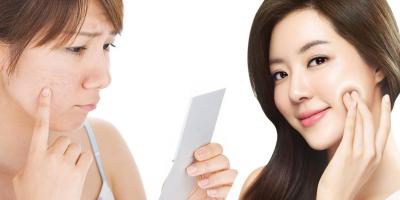 Kem trị sẹo vết thương tốt nhất hiện nay