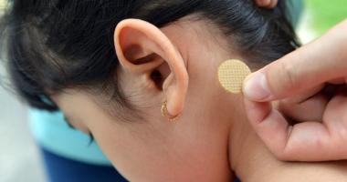 Miếng dán chống say tàu xe hiệu quả, được tin dùng hiện nay