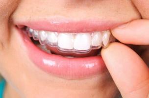 Phòng khám nha khoa tốt nhất quận Hoàng Mai, Hà Nội