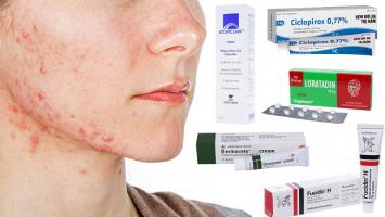 Sản phẩm chữa viêm da tiết bã hiệu quả được bác sĩ khuyên dùng hiện nay