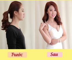 Địa chỉ nâng ngực đẹp và an toàn nhất tỉnh Khánh Hòa