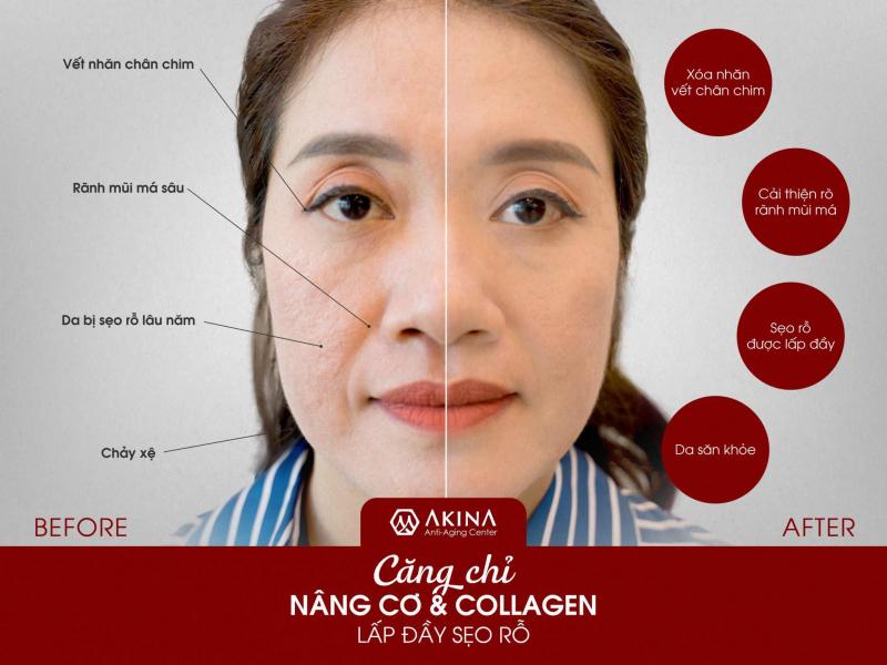 AKINA ANTI AGING Center