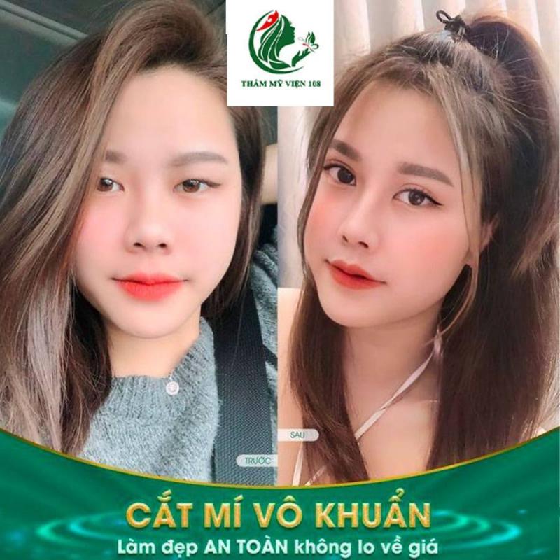 Bác Sĩ 108 Hà Nội Khoa Phẫu Thuật Thẩm Mỹ - Cơ Sở Hà Tĩnh