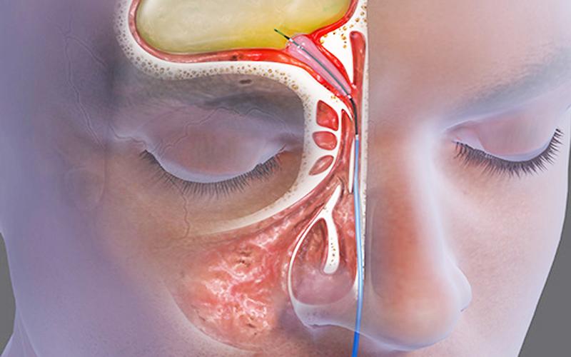 Bác Sĩ Tai Mũi Họng Nguyễn Thị Hạnh