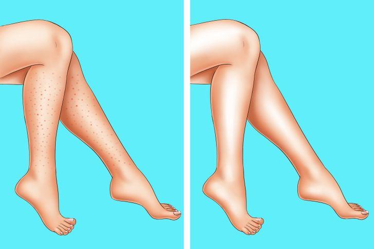 Bất cứ nơi nào trên cơ thể bạn sau khi cạo bằng dao cạo