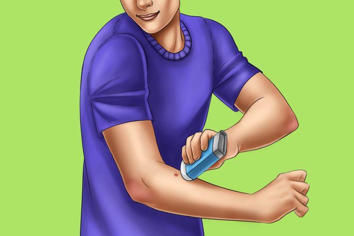 Khi bị muỗi đốt