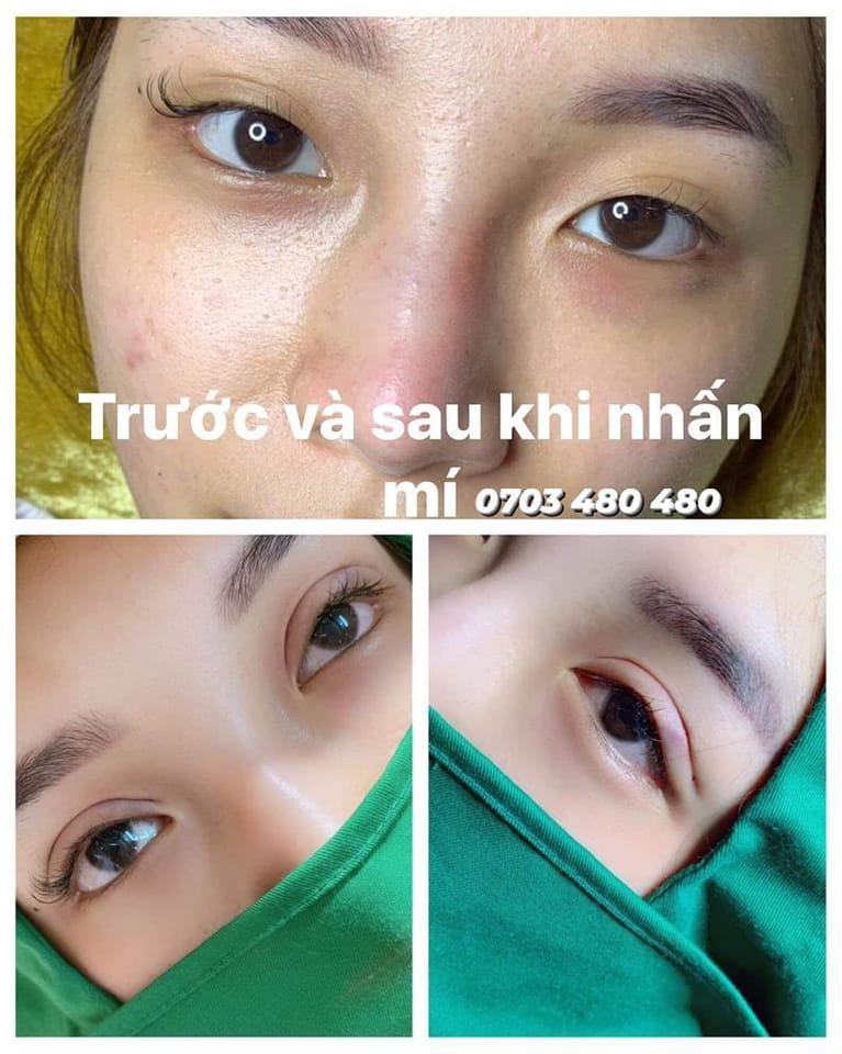 Beauty Spa Quyên Quyên