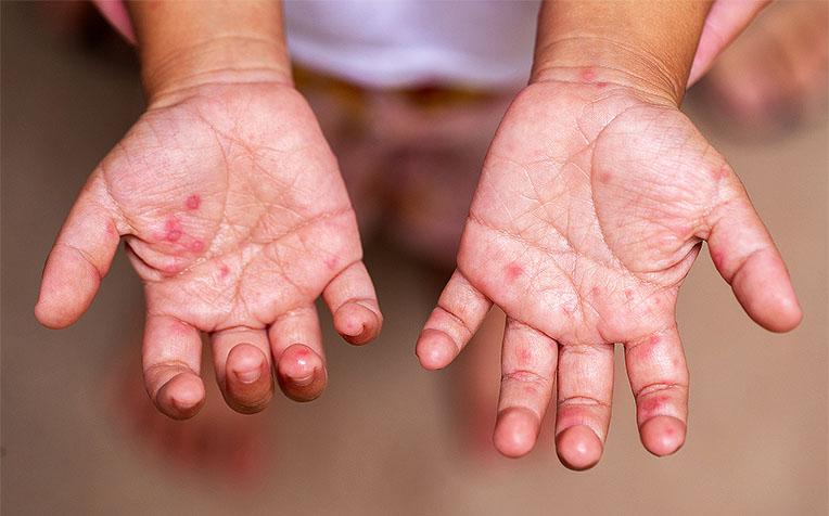 Bệnh viện Bệnh nhiệt đới trung ương