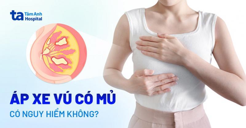 Bệnh viện Đa khoa Tâm Anh