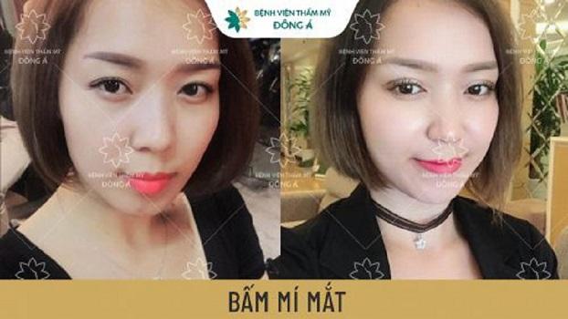 Bệnh viện Thẩm mỹ Đông Á Bình Dương