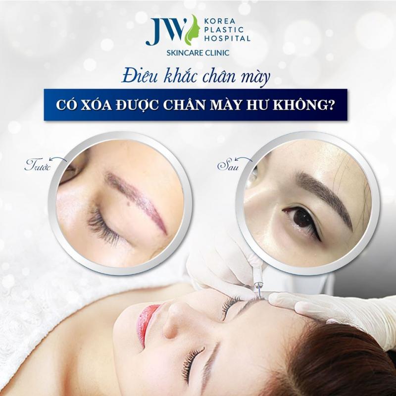 Bệnh viện thẩm mỹ JW Hàn Quốc