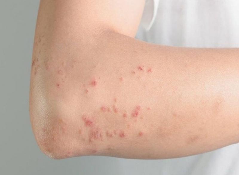 Tác dụng phụ sản phẩm