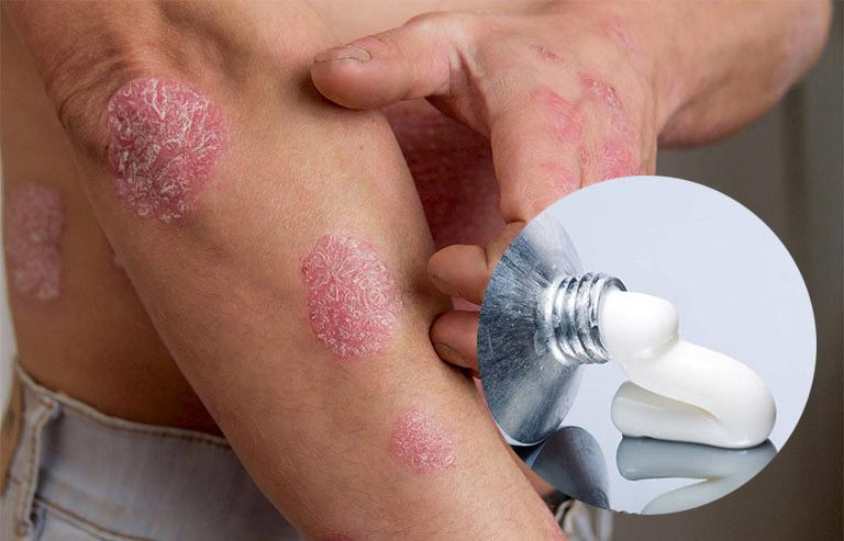 Tác dụng phụ sản phẩm