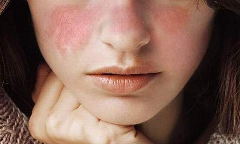 Tác dụng phụ sản phẩm