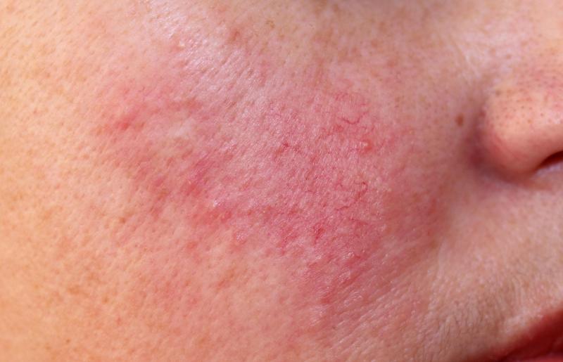 Tác dụng phụ của sản phẩm