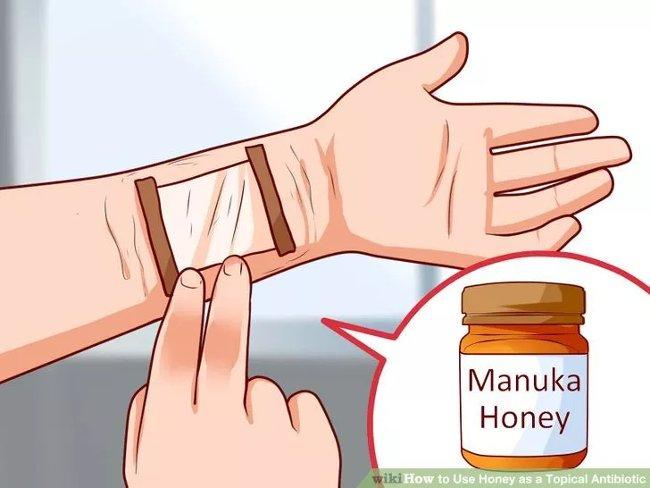 Chữa lành vết thương bằng mật ong