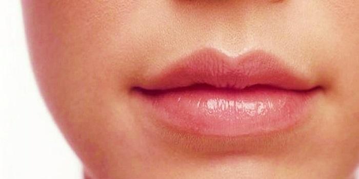 Độ góc cạnh của miệng