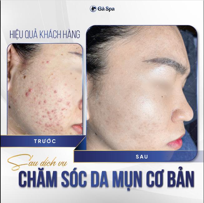 Gà Spa Thủ Đức