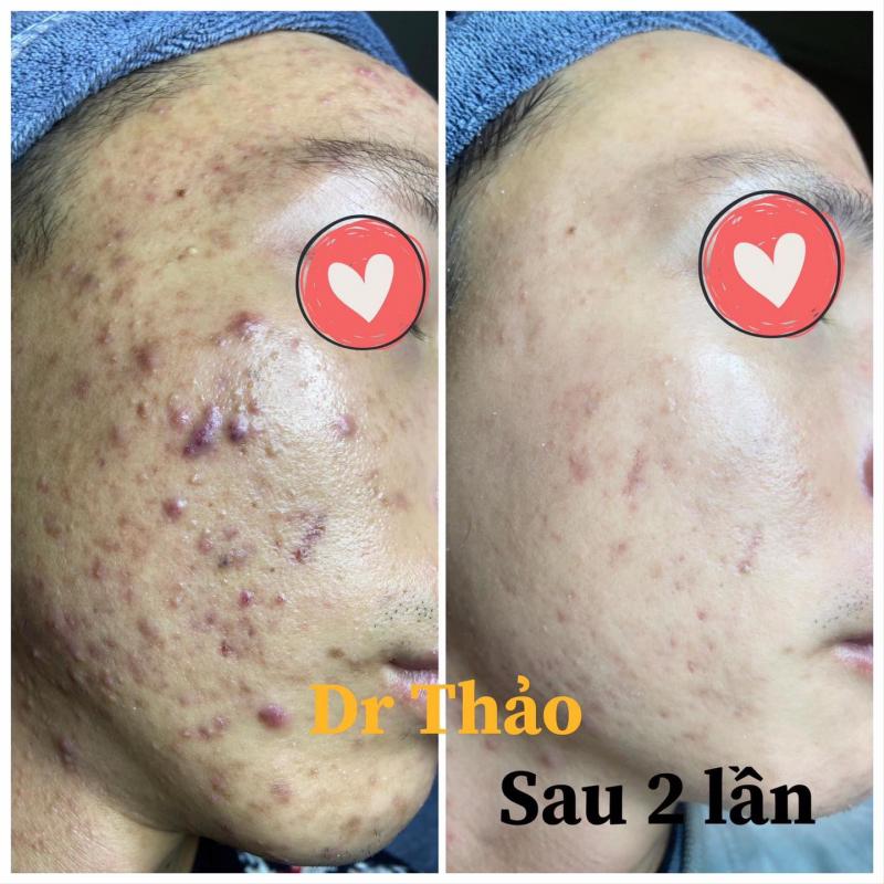 Grace Beauty - Bác Sĩ Thảo Da Liễu Thẩm Mỹ