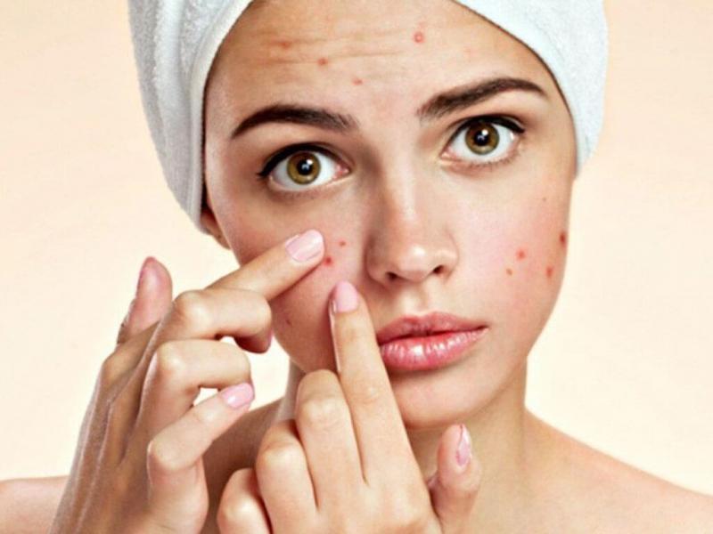 Mỗi lần rửa mặt xong không nên dùng khăn mặt lau khô
