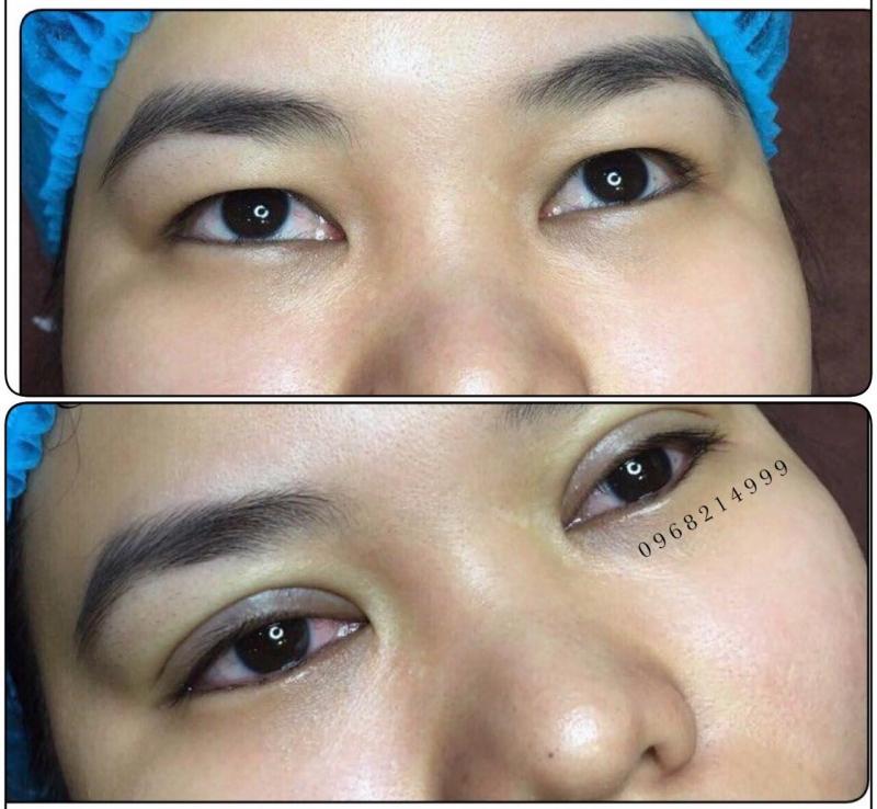 Hạnh Phương nhấn mí