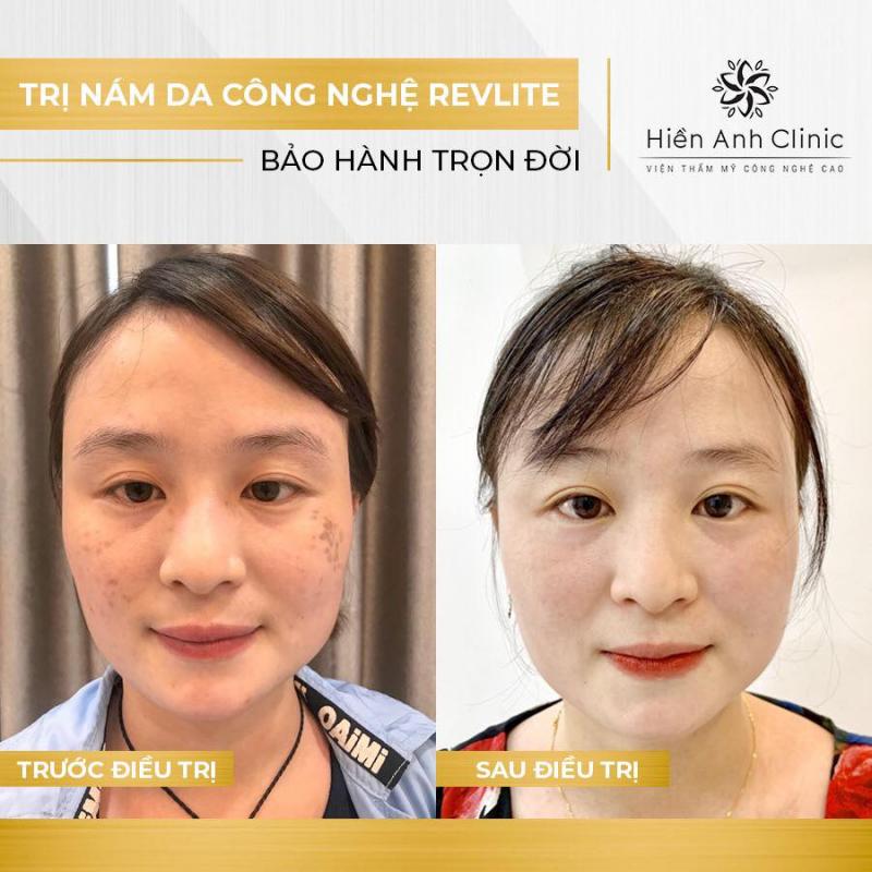 Hiền Anh Clinic