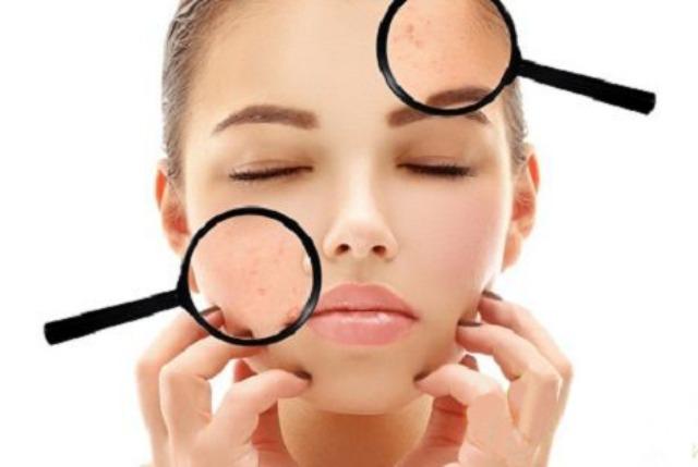 Hiểu đúng làn da, tình trạng da trước khi mua mỹ phẩm