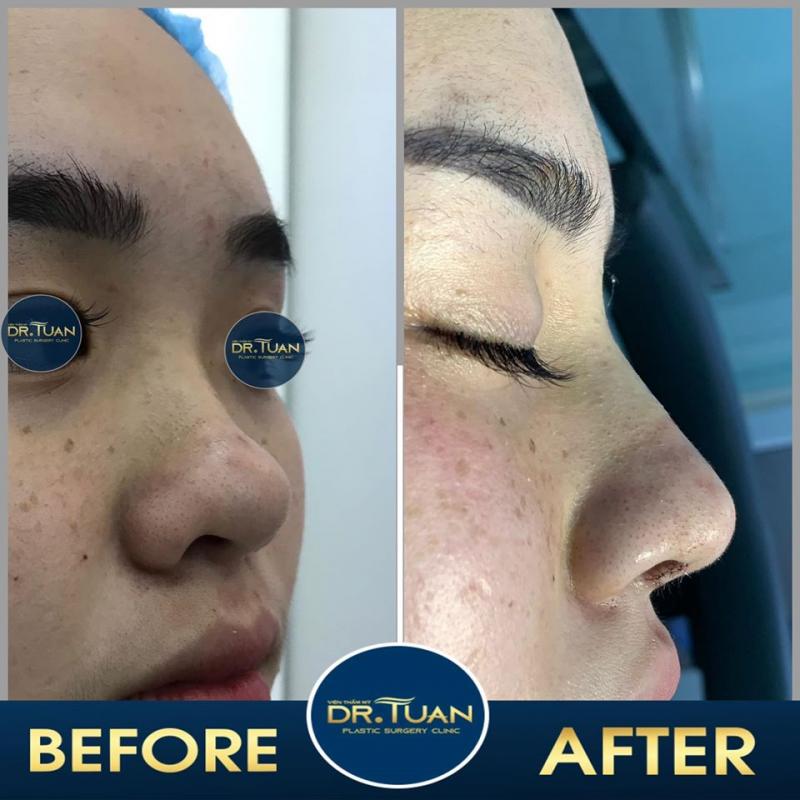 Thẩm Mỹ BS Tuấn
