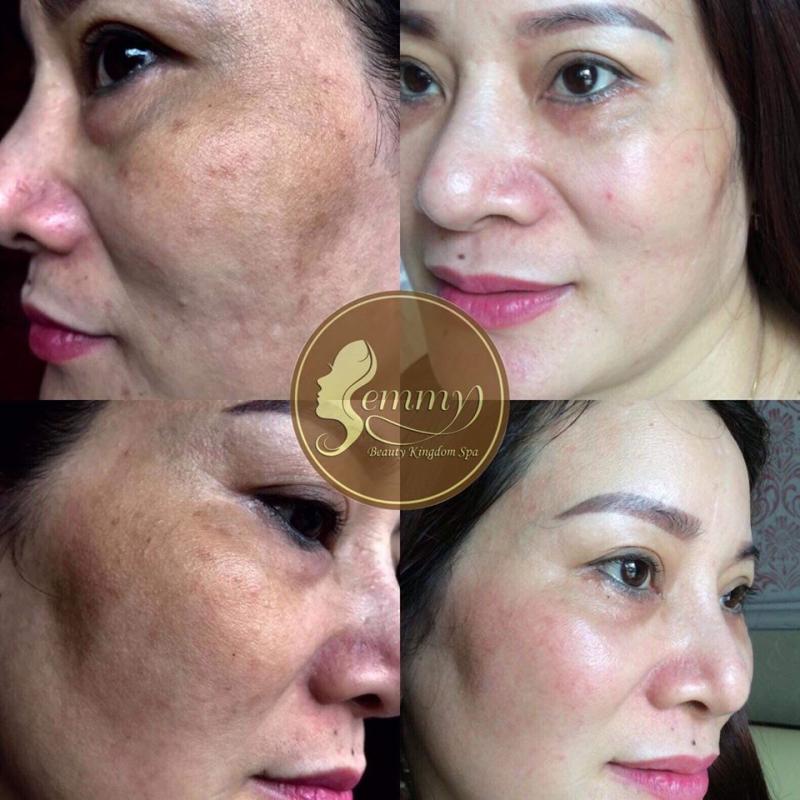 Thẩm Mỹ Emmy Huế