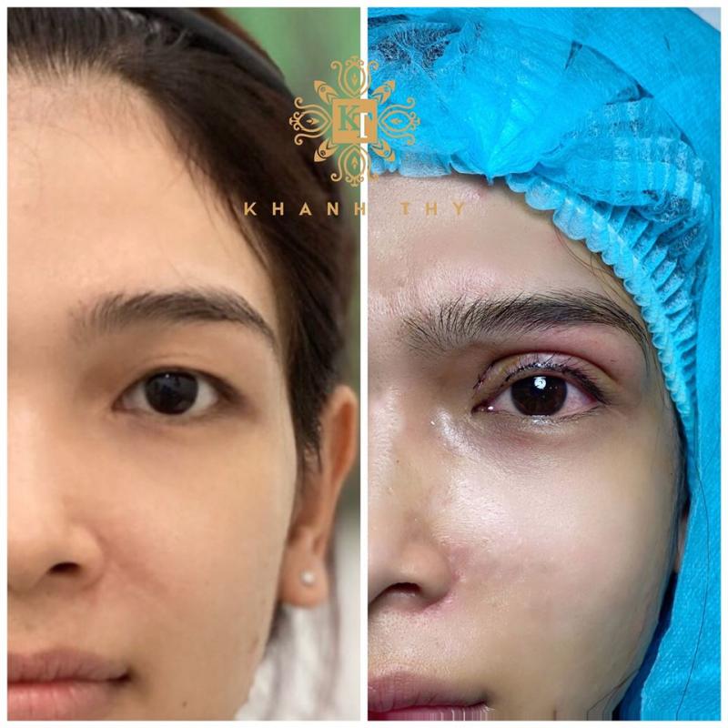 Thẩm Mỹ Viện Khánh Thy