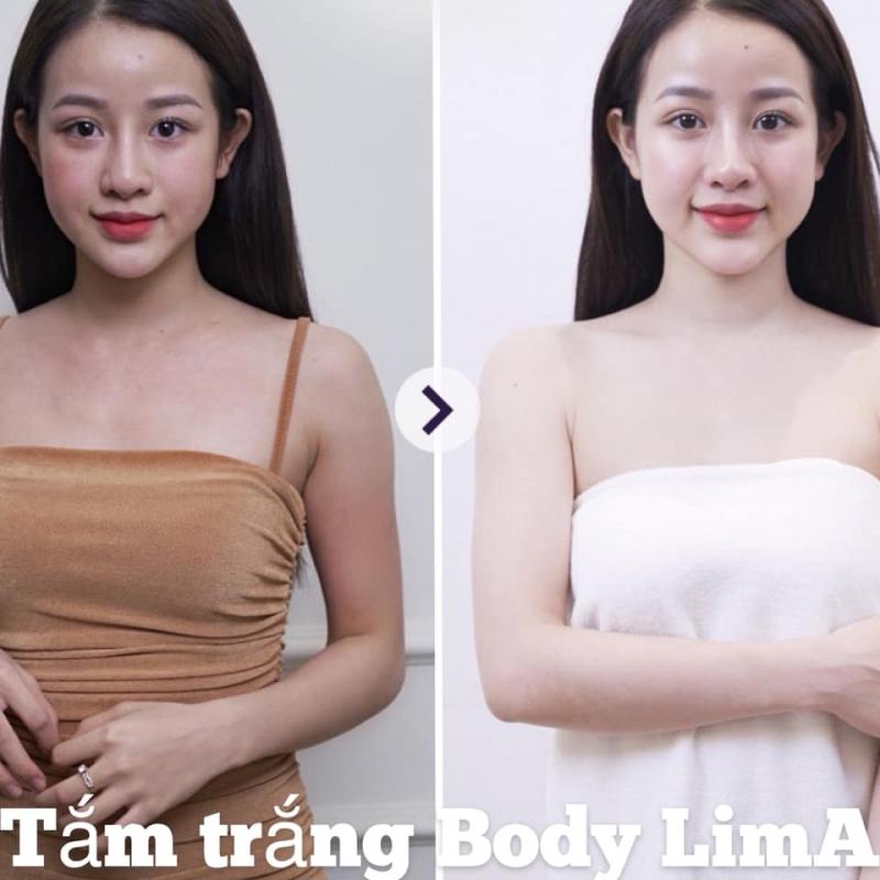 Thẩm Mỹ Quốc Tế Lim A