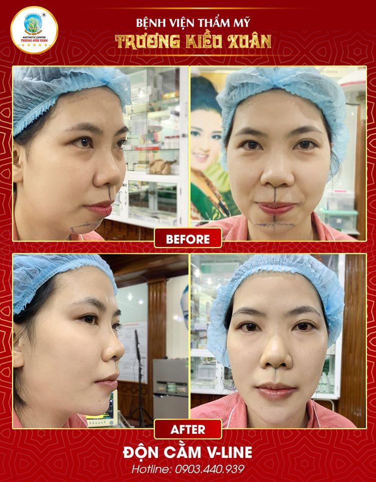 Bệnh Viện Thẩm Mỹ Trương Kiều Xuân