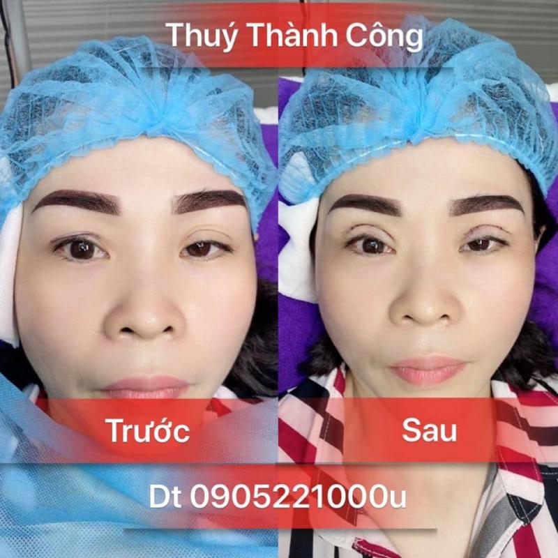 Thẩm Mỹ Viện Dorine by Thúy