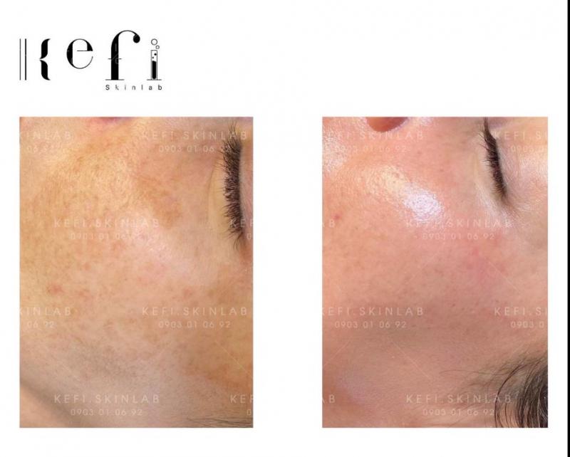 Kefi Skinlab