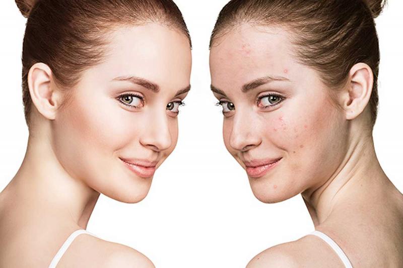 Kiên nhẫn khi sử dụng mỹ phẩm