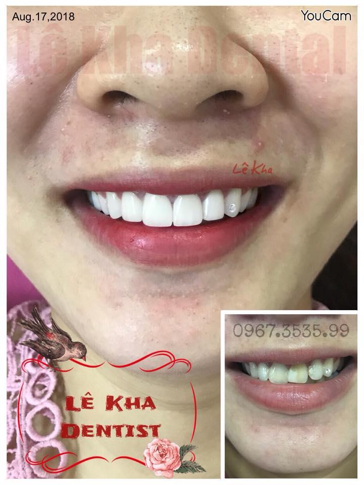 LêKha Dental