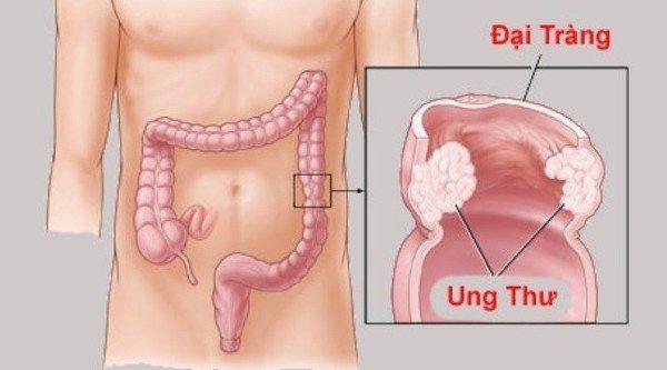 Lười vận động