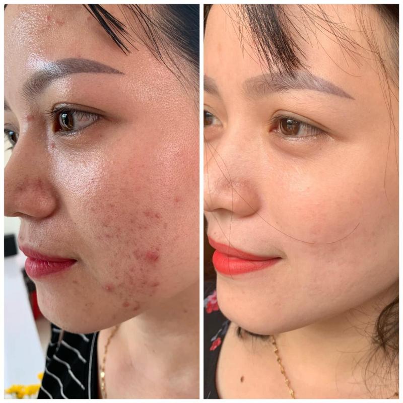Luxury Beauty Spa Quy Nhơn