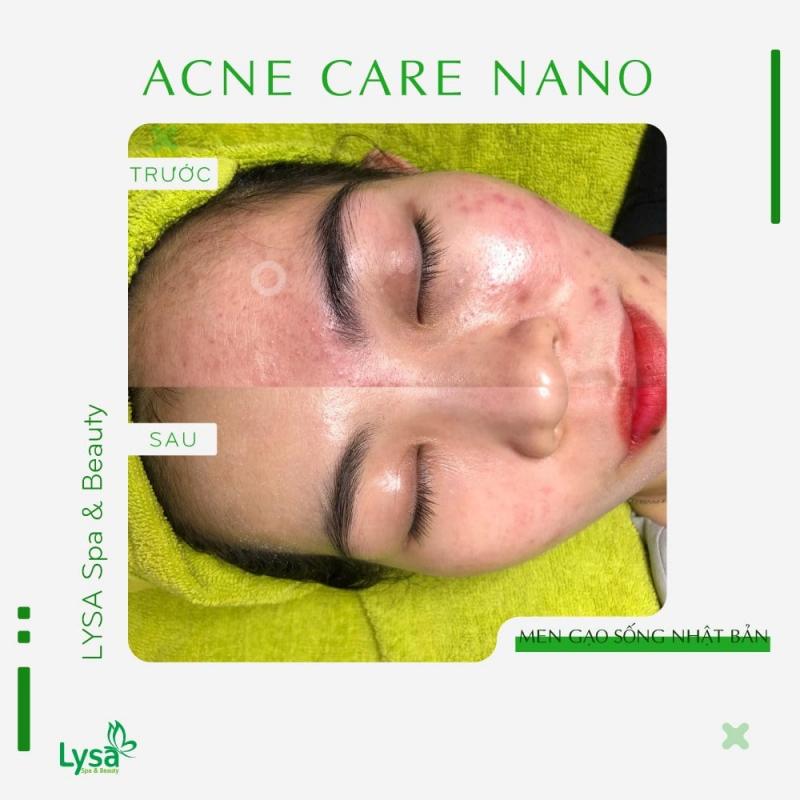LYSA Spa & Beauty