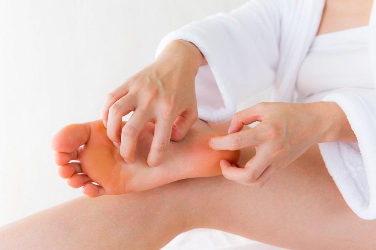 Loại bỏ nứt gót chân