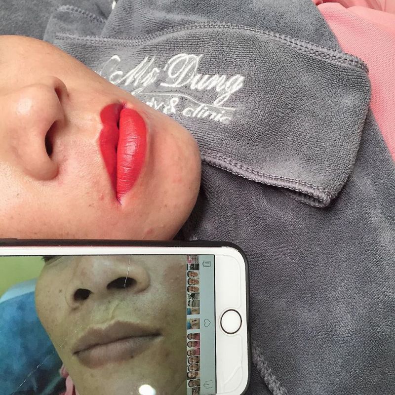 Mỹ Dung Spa