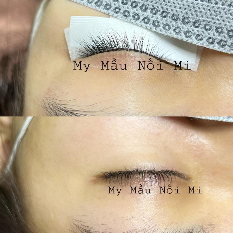 My Mầu Nối Mi